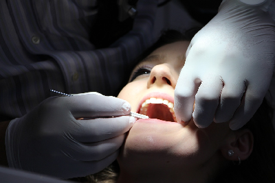 Zapalenie okostnej zęba i jego charakterystyka